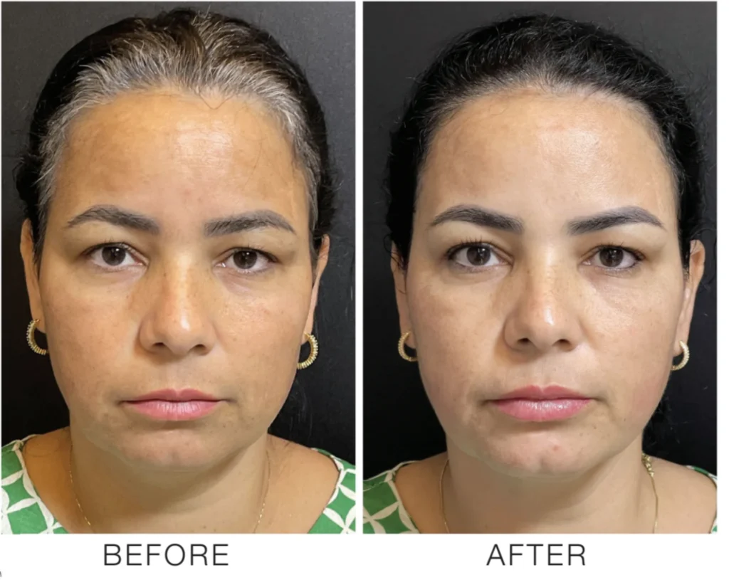 Bioidentical hormone therapy Park City